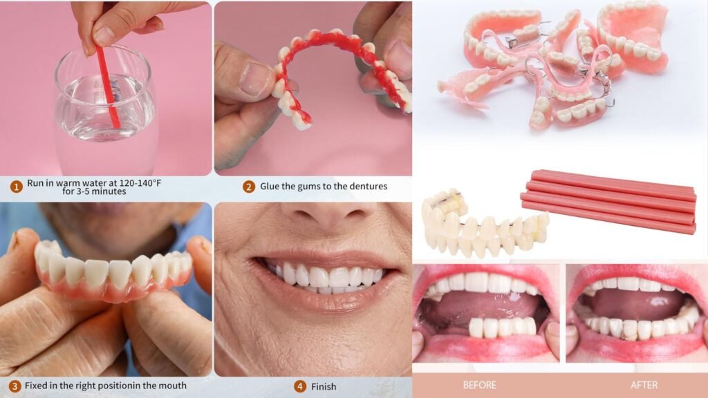 diy dentures at home